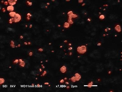 Mycobacterium abscessus—Bronchial Epithelial Cells Cross-Talk Through Type I Interferon Signaling